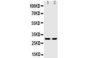 Anti-Kallikrein 1 antibody, Western blotting Lane 1: Rat Pancreas Tissue Lysate Lane 2: Rat Kidney Tissue Lysate (Kallikrein 1 anticorps  (C-Term))
