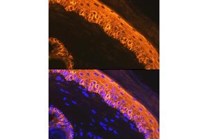 Immunofluorescence analysis of rat skin using Cytokeratin 1 (KRT1) (KRT1) Rabbit mAb (ABIN7268085) at dilution of 1:100 (40x lens). (Cytokeratin 1 anticorps)