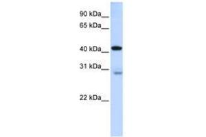 Image no. 1 for anti-GRAM Domain Containing 2 (GRAMD2) (AA 144-193) antibody (ABIN6740892) (GRAMD2 anticorps  (AA 144-193))