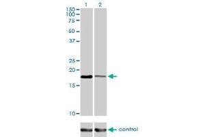 Western blot analysis of BIRC5 over-expressed 293 cell line, cotransfected with BIRC5 Validated Chimera RNAi (Lane 2) or non-transfected control (Lane 1).