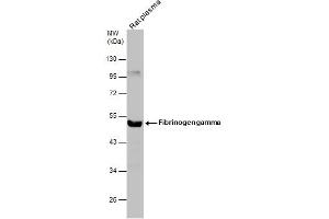 WB Image Rat tissue extract (50 μg) was separated by 10% SDS-PAGE, and the membrane was blotted with Fibrinogen gamma antibody , diluted at 1:500. (FGG anticorps)