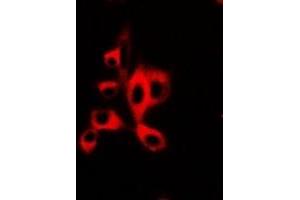 Immunofluorescent analysis of AdipoR1 staining in U20S cells.