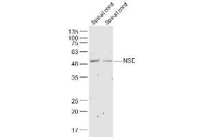 Lane 1: Mouse Spinal cord lysates Lane 2: Rat Spinal cord lysates probed with NSE Polyclonal Antibody, Unconjugated  at 1:300 dilution and 4˚C overnight incubation. (ENO2/NSE anticorps  (AA 201-300))