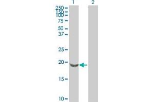 Western Blot analysis of SNCB expression in transfected 293T cell line by SNCB MaxPab polyclonal antibody. (beta Synuclein anticorps  (AA 1-134))