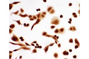 ICC testing of A549 cells (TCP1 alpha/CCTA anticorps  (AA 82-98))