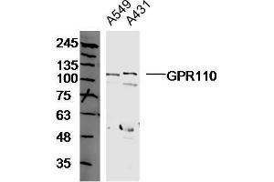 Human A549 and A431 cell lysates probed with GPR110 Polyclonal Antibody, unconjugated  at 1:300 overnight at 4°C followed by a conjugated secondary antibody at 1:10000 for 90 minutes at 37°C. (G Protein-Coupled Receptor 110 anticorps  (AA 51-150))