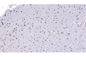 Detection of CC16 in Human Cerebrum Tissue using Monoclonal Antibody to Clara Cell Protein 16 (CC16)