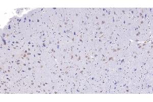 Detection of CC16 in Human Cerebrum Tissue using Monoclonal Antibody to Clara Cell Protein 16 (CC16) (SCGB1A1 anticorps  (AA 23-91))