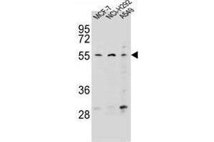 ZNF117 Antibody (N-term) western blot analysis in MCF-7,NCI-H292,A549 cell line lysates (35 µg/lane). (Zinc Finger Protein 117 anticorps  (N-Term))
