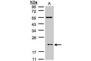 WB Image Sample(30 μg of whole cell lysate) A:Raji , 12% SDS PAGE antibody diluted at 1:500
