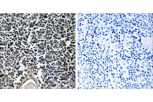 Peptide - +Immunohistochemistry analysis of paraffin-embedded human thymus gland tissue using ABCB7 antibody. (ABCB7 anticorps)