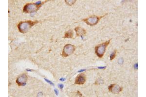 Immunohistochemical staining of paraffin embedded rat brain tissue section with PPID polyclonal antibody . (PPID anticorps  (C-Term))