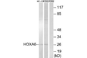 Western blot analysis of extracts from HT-29 cells and K562 cells, using HOXA6 antibody.