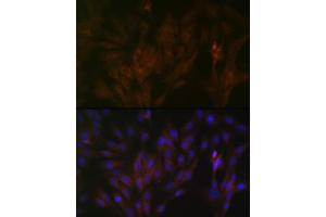 Immunofluorescence analysis of C6 cells using 15-PGDH/HPGD Rabbit mAb (ABIN7267807) at dilution of 1:100 (40x lens).