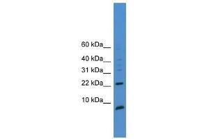 Western Blot showing PSCA antibody used at a concentration of 1-2 ug/ml to detect its target protein. (PSCA anticorps  (C-Term))
