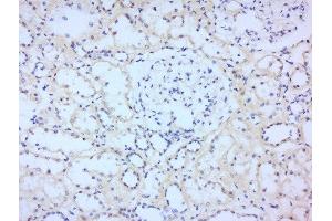 Paraformaldehyde-fixed, paraffin embedded human kidney tissue, Antigen retrieval by boiling in sodium citrate buffer(pH6) for 15min, Block endogenous peroxidase by 3% hydrogen peroxide for 30 minutes, Blocking buffer (normal goat serum) at 37°C for 20min, Antibody incubation with Rabbit Anti-STAT2 Polyclonal Antibody, Unconjugated  at 1:200 overnight at 4°C, followed by a conjugated secondary and DAB staining
