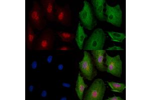 Phospho-YAP (Ser941) Antibody staining A549 cells(4h of LPS treatment) by IF/ICC. (YAP1 anticorps  (pSer941))