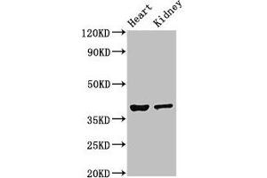 Western Blot Positive WB detected in: Mouse heart tissue, Mouse kidney tissue All lanes: NEUROD1 antibody at 4 μg/mL Secondary Goat polyclonal to rabbit IgG at 1/50000 dilution Predicted band size: 40 kDa Observed band size: 40 kDa (NEUROD1 anticorps  (AA 154-356))