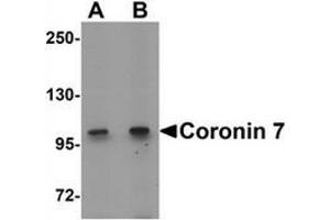 Western blot analysis of Coronin 7 in rat lung tissue lysate with Coronin 7 antibody at (A) 1 and (B) 2 ug/mL. (Coronin 7 anticorps  (C-Term))