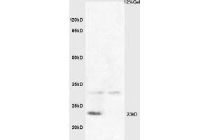 Lane 1: sheep non-fat milk Lane 2: bovine non-fat milk probed with Anti Beta-casein Polyclonal Antibody, Unconjugated (ABIN668976) at 1:200 in 4 °C. (CSN2 anticorps  (AA 151-222))