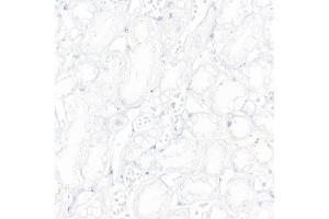 Immunohistochemistry of paraffin-embedded Human kidney (negative control sample) using CD19 antibody (ABIN7266169) at dilution of 1:10000 (40x lens).