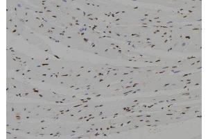 ABIN6272522 at 1/100 staining Mouse heart tissue by IHC-P. (NHLH2 anticorps  (Internal Region))