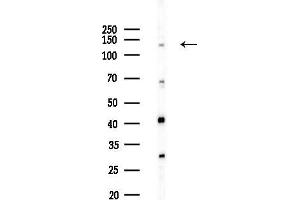 Western blot analysis of lysates from HepG2 cells(heat-shock,45 min treatment), using EIF5B Antibody at 1/1000 dilution.