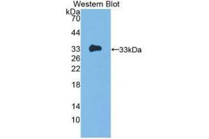 Western blot analysis of recombinant Human IL12A. (IL12A anticorps  (AA 23-219))