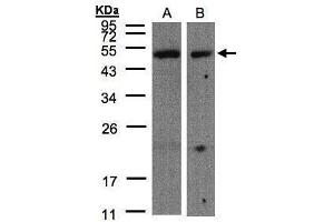WB Image Sample(30 μg of whole cell lysate) A:A431, B:Hep G2, 10% SDS PAGE antibody diluted at 1:500 (CARD8 anticorps  (C-Term))