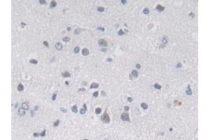 Detection of MIB2 in Human Cerebrum Tissue using Polyclonal Antibody to Mindbomb Homolog 2 (MIB2)