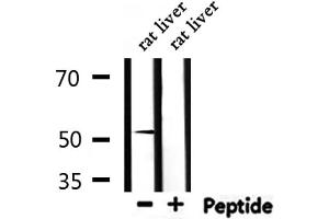Western blot analysis of extracts from rat liver, using NR0B1 Antibody.