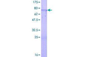 Image no. 1 for Zinc Finger Protein 669 (ZNF669) (AA 1-464) protein (GST tag) (ABIN1326367)