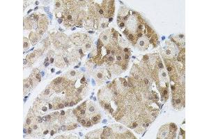 Immunohistochemistry of paraffin-embedded Human stomach using MARVELD2 Polyclonal Antibody (Tricellulin anticorps)