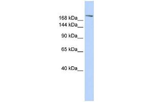WB Suggested Anti-CCNB3 Antibody Titration:  0. (Cyclin B3 anticorps  (C-Term))