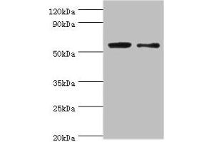 Western blot All lanes: PGD antibody at 2 μg/mL Lane 1: EC109 whole cell lysate Lane 2: 293T whole cell lysate Secondary Goat polyclonal to rabbit IgG at 1/15000 dilution Predicted band size: 54, 52 kDa Observed band size: 54 kDa (PGD anticorps  (AA 4-483))