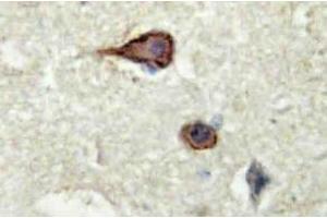 Immunohistochemistry analysis of EMMPRIN Antibody in paraffin-embedded human brain tissue. (CD147 anticorps)