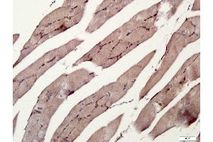 Paraformaldehyde-fixed, paraffin embedded rat skeletal muscle tissue, Antigen retrieval by boiling in sodium citrate buffer(pH6) for 15min, Block endogenous peroxidase by 3% hydrogen peroxide for 30 minutes, Blocking buffer (normal goat serum) at 37°C for 20min, Antibody incubation with Rabbit Anti-RANK Polyclonal Antibody, Unconjugated  at 1:400 overnight at 4°C, followed by a conjugated secondary and DAB staining
