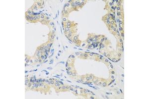 Immunohistochemistry of paraffin-embedded human prostate using UPF2 antibody.