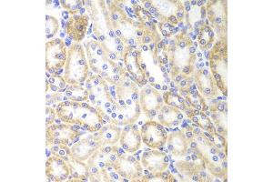 Immunohistochemistry of paraffin-embedded rat kidney using SIRT3 antibody (ABIN5974409) at dilution of 1/100 (40x lens). (SIRT3 anticorps)
