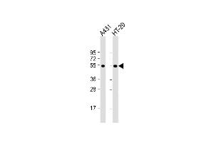 All lanes : Anti-p53 Antibody  at 1:2000 dilution Lane 1: A431 whole cell lysate Lane 2: HT-29 whole cell lysate Lysates/proteins at 20 μg per lane. (p53 anticorps  (AA 293-322))