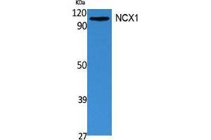 Western Blotting (WB) image for anti-Solute Carrier Family 8 (Sodium/calcium Exchanger), Member 1 (SLC8A1) (Internal Region) antibody (ABIN6282737)