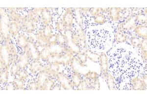 Detection of PLTP in Rat Kidney Tissue using Polyclonal Antibody to Phospholipid Transfer Protein (PLTP) (PLTP anticorps  (AA 337-479))
