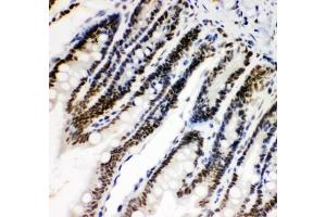 IHC-P: HIF-1-alpha antibody testing of rat intestine tissue