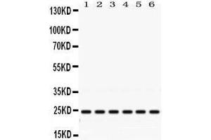 Western Blotting (WB) image for anti-RAB5A, Member RAS Oncogene Family (RAB5A) (AA 179-215), (C-Term) antibody (ABIN3043917) (RAB5 anticorps  (C-Term))