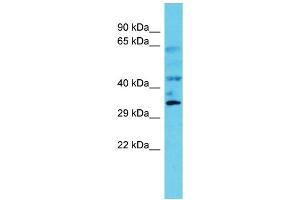 Host: Rabbit Target Name: C6orf106 Sample Type: Fetal Kidney lysates Antibody Dilution: 1.