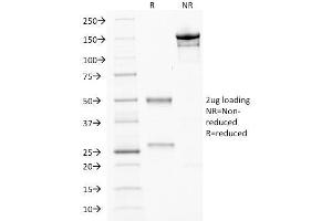 SDS-PAGE Analysis Purified CDX2 Mouse Monoclonal Antibody (CDX2/2214). (CDX2 anticorps)