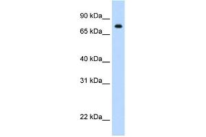 WB Suggested Anti-STAT1 Antibody Titration:  1 ug/ml  Positive Control:  STAT1