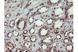 Image no. 1 for anti-Chaperonin Containing TCP1, Subunit 8 (Theta)-Like 2 (CCT8L2) antibody (ABIN1497479)