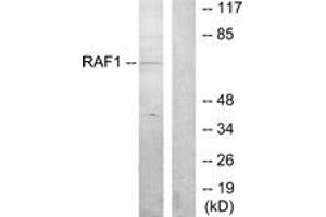 Western blot analysis of extracts from K562 cells, using C-RAF (Ab-259) Antibody. (RAF1 anticorps  (AA 225-274))