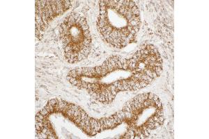Immunohistochemistry (IHC) image for anti-ATP Synthase, H+ Transporting, Mitochondrial F1 Complex, alpha Subunit 1, Cardiac Muscle (ATP5A1) (AA 175-225) antibody (ABIN7453915)
